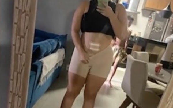 Pacientes acusam m&eacute;dicos por cirurgias pl&aacute;sticas malfeitas no RJ e na  Bahia; um deles teria realizado procedimento sem anestesia - Nossa Metr&oacute;pole